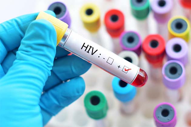 Where are the Nurses in the HIV Response? 