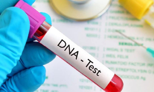 Afghanistan Opens Its First and Only DNA Diagnostics Center