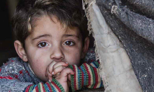 Poor Diets Damaging Children’s  Health Worldwide and in Afghanistan, Warns UNICEF