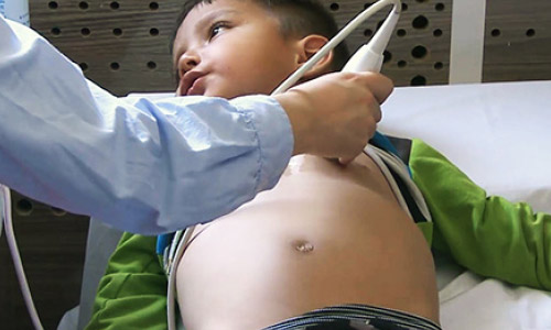 61 Afghan Children Treated  in China for Heart Disease