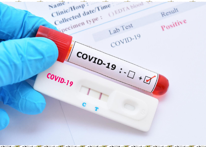 708 New Cases of COVID-19, 35 Deaths Reported in Afghanistan
