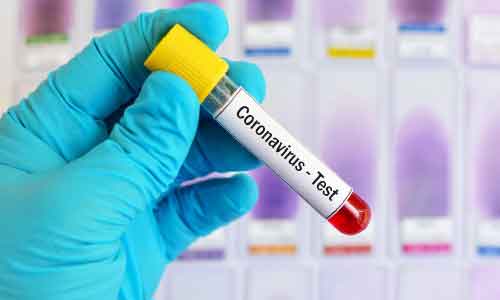 Afghanistan Coronavirus Updates: 34,194 Cases,  971 Deaths